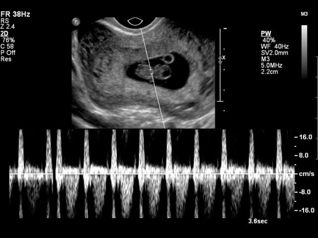 baby boo nov 12