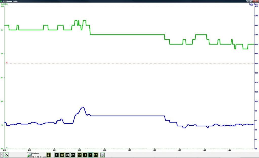 Oximeter Readings Chart